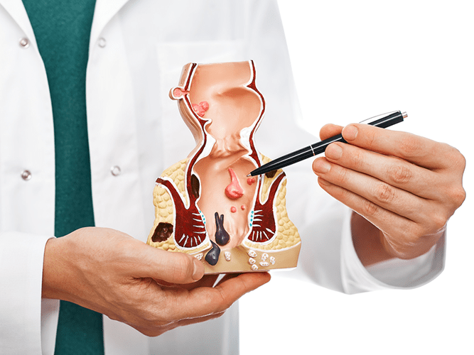 Doctor explaining laser piles treatment to a patient